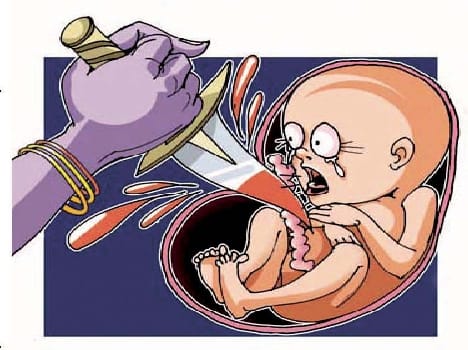 Private nursing homes have found the girl's fetus